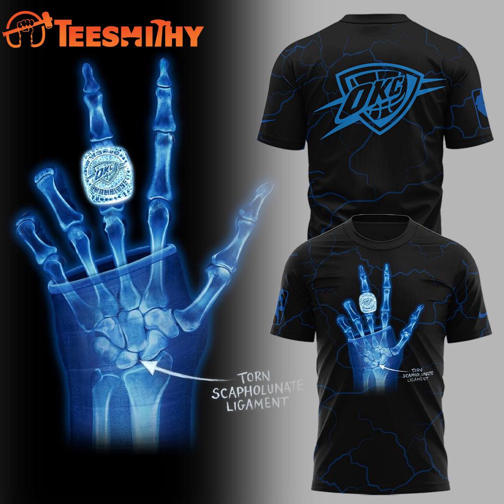 Oklahoma City Thunder Jalen Williams X-Ray Scapholunate Torn But The Championships Worn 3D Shirt Oklahoma City Thunder Jalen Williams X-Ray Scapholunate Torn But The Championships Worn 3D Shirt